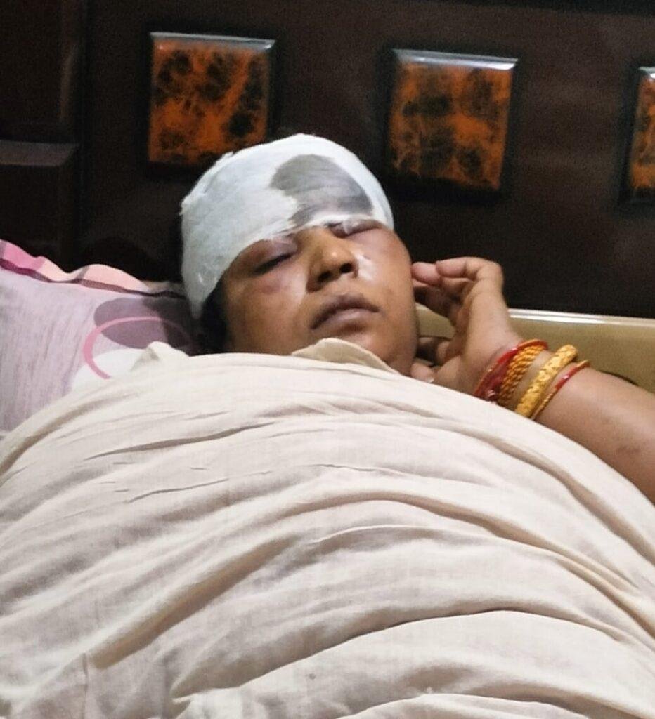 कार पलटने से सभासद की पत्नी समेत तीन लोग हुए घायल