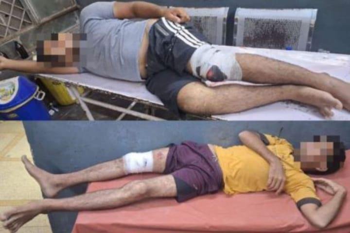 27 लूटों को अंजाम देने वाले लुटेरे पुलिस मुठभेड़ में गिरफ्तार, दोनों गोली लगने से हुए घायल