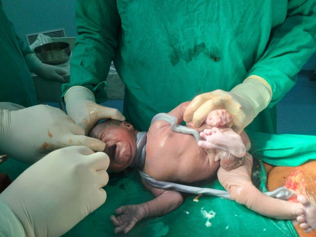वनांचल लैलूंगा में सुरक्षित मातृत्व की नई मिसाल, शासन को नीति से सशक्त हो रही स्वास्थ्य सेवा एंएमसीएच लैलूंगा में विशेषज्ञ सेवाओं से बढ़ा संस्थागत प्रसव, 574 सुरक्षित डिलीवरी कर रचा इतिहासदंत चिकित्सक की तैनाती से ग्रामीणों को राहत, 3 हजार से अधिक मरीजों को मिला उपचार