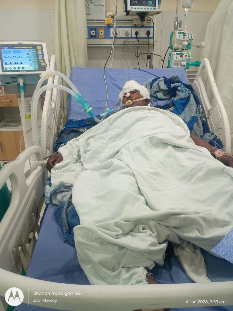 अज्ञात वाहन की टक्कर से साइकिल चालक गंभीर घायल