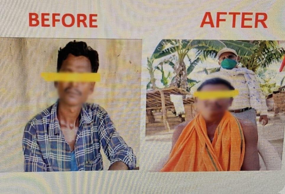 कुष्ठ रोग का समय पर इलाज से सामान्य जीवन जी रहे